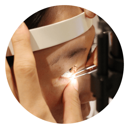 マイボーム腺からの脂分圧出